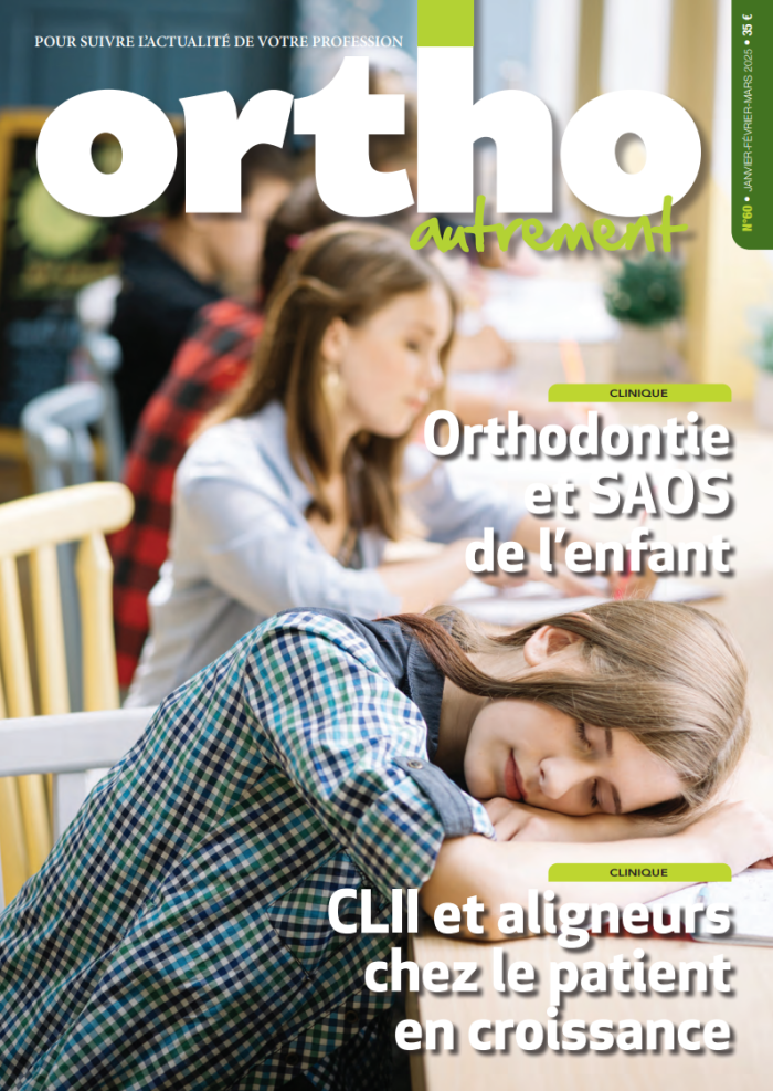 OA60