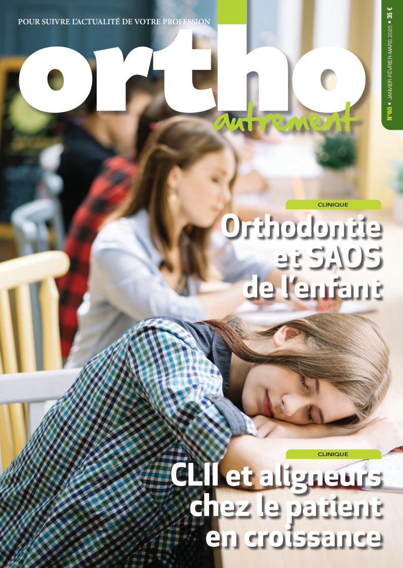 OA60